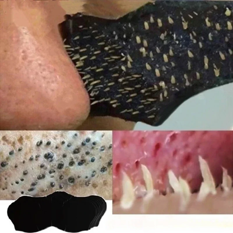Charcoal Pore Strip - 유니섹스 블랙헤드 제거 마스크 비강 스트립