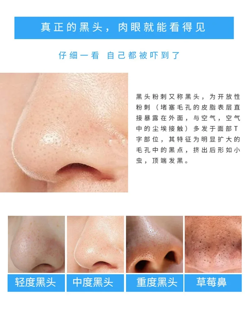 30개 대나무 숯 코 스트립, 모공 클렌징을 위한 블랙 - Charcoal Pore Strip 리뷰 및 가격