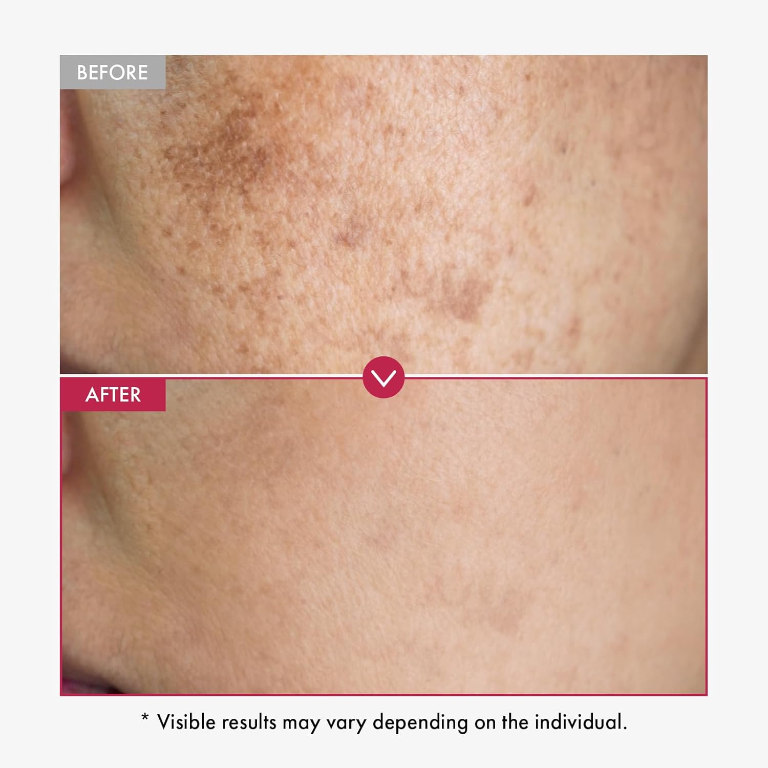 알파 알부틴 세럼 AHA는 얼굴과 바디 세럼을 부드럽게 - Alpha Arbutin Serum 리뷰 및 가격