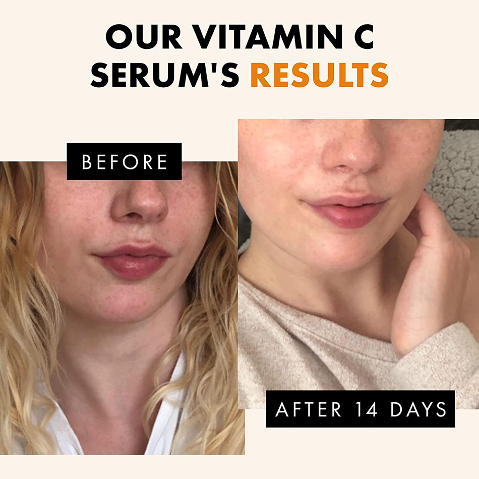 120ml 99% 비타민 C 세럼 오일 페이셜 세럼 A - Alpha Arbutin Serum 리뷰 및 가격