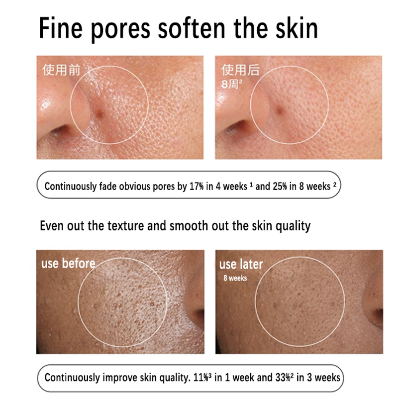 알로에 2% + NAG 2% 솔루션 세럼 30ml 멀티 - Alpha Arbutin Serum 리뷰 및 가격