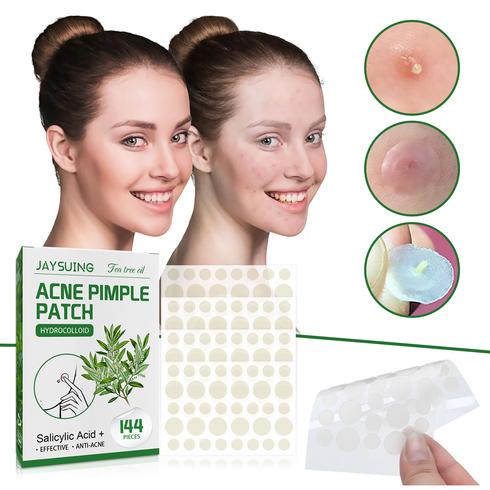 하이드로콜로이드 여드름 패치 - 점액 및 유분 흡수,  - Hydrocolloid Acne Patch 리뷰 및 가격