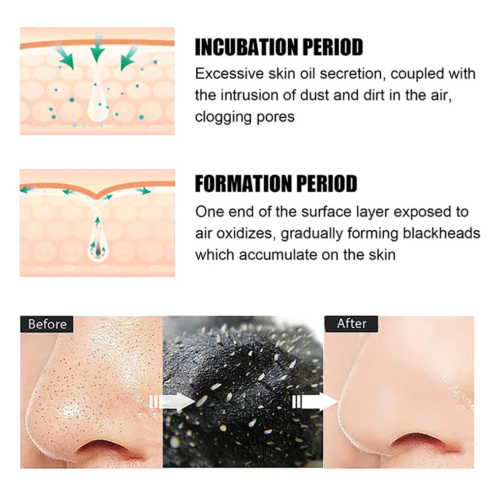 10/20/50/100PCS 남녀공용 여드름 및 뾰루지 - Charcoal Pore Strip 리뷰 및 가격