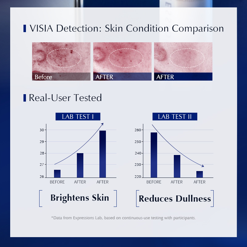 나이아신아마이드 & 알파 알부틴 함유 브라이트닝 다크  - Alpha Arbutin Serum 리뷰 및 가격