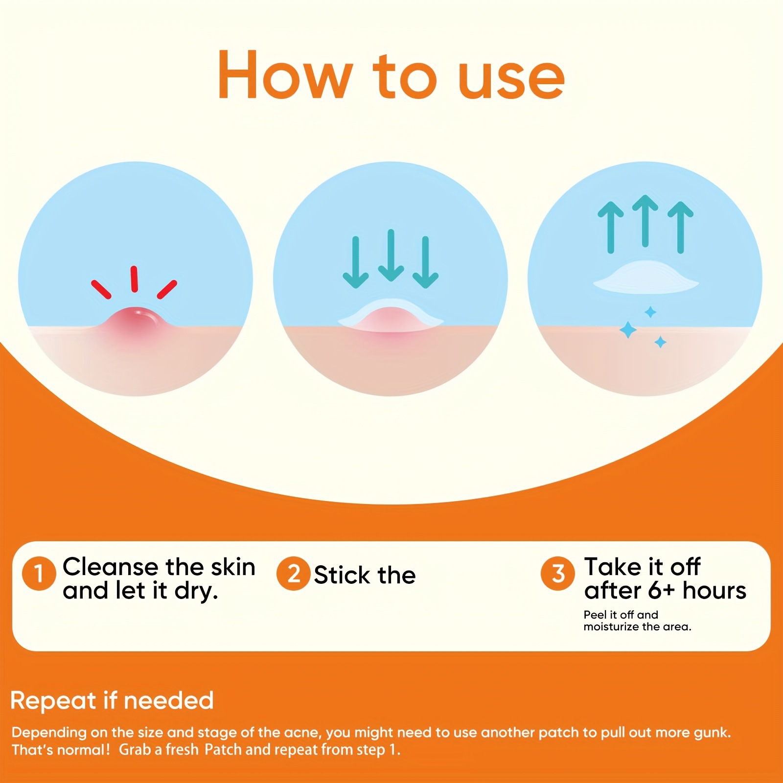 435개의 투명한 여드름 패치, 알코올 무첨가, 순하고 - Hydrocolloid Acne Patch 리뷰 및 가격