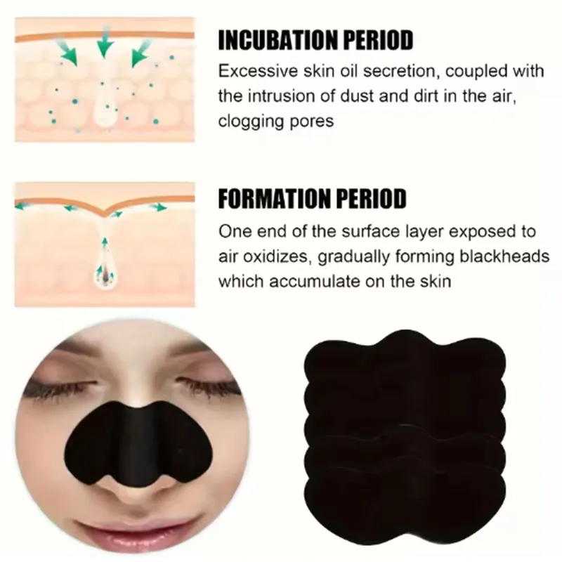 10/20/50개입 숯 블랙헤드 제거 코팩, 블랙헤드  - Charcoal Pore Strip 리뷰 및 가격